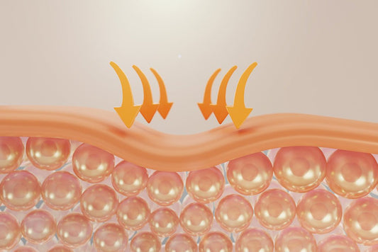 Skin Barrier