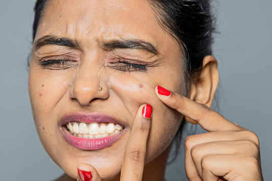 The Right Approach for Treating Dry Skin and Acne | SkinQ