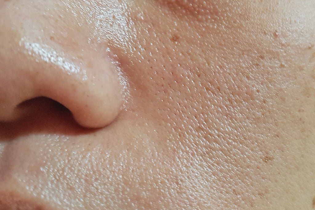 Get Your Skin Ready for Wedding Season with These Essential Oily Skincare Products