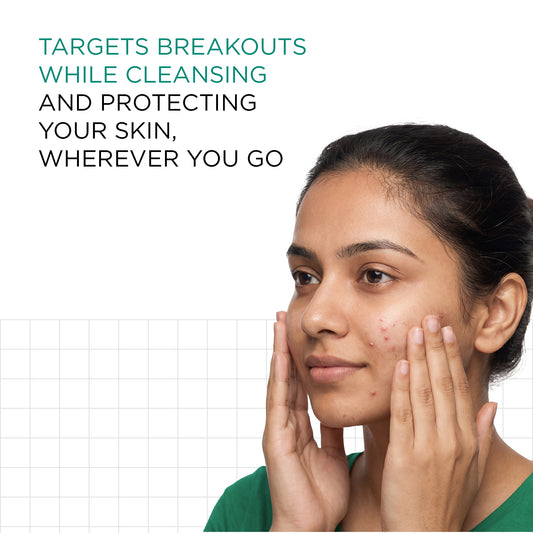 Acne Control Trial Kit
