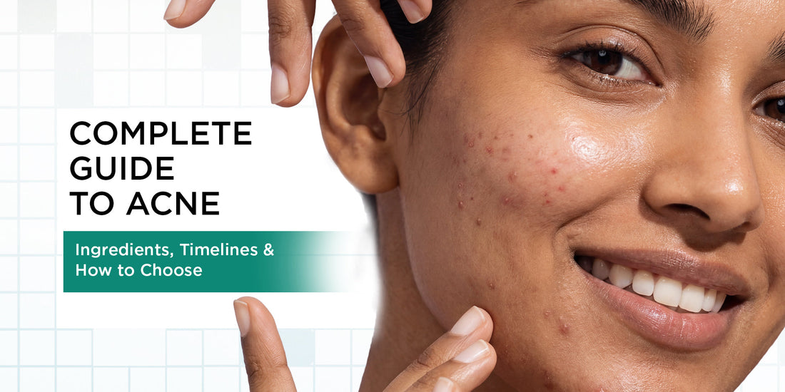 Complete Guide to Acne: Ingredients, Timelines & How to Choose