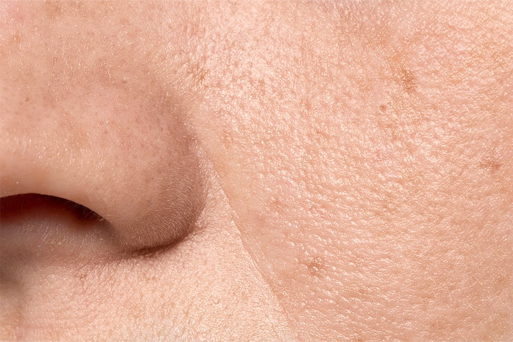 Reduce Big Pores: Easy Solutions for the Causes | SkinQ