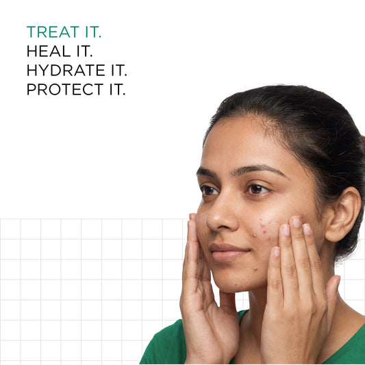 Acne Control & Protect Kit