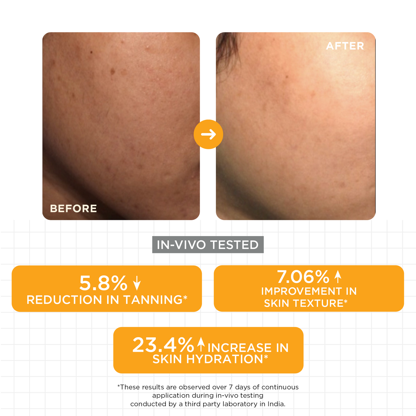 15% Vitamin C Glow Serum