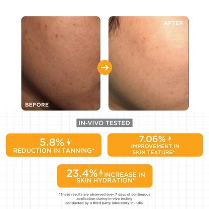 15% Vitamin C Glow Serum