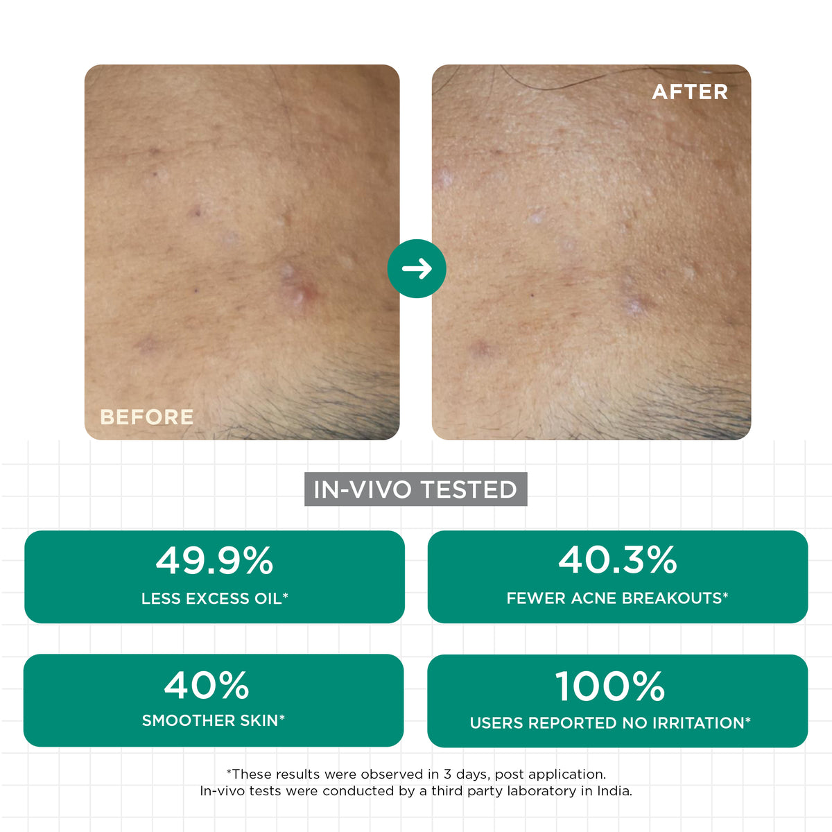 Acne Clear Face Wash