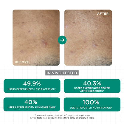 Acne Clear Salicylic Face Wash