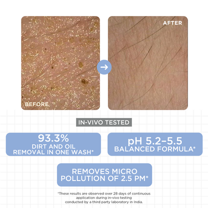 Daily Gentle Cleanser