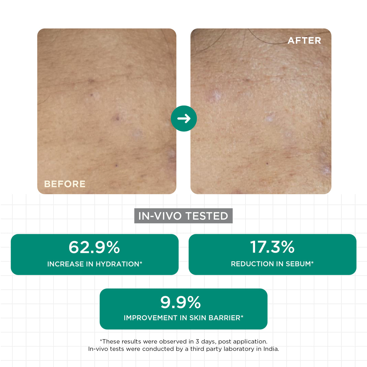 Acne Clear Moisturiser