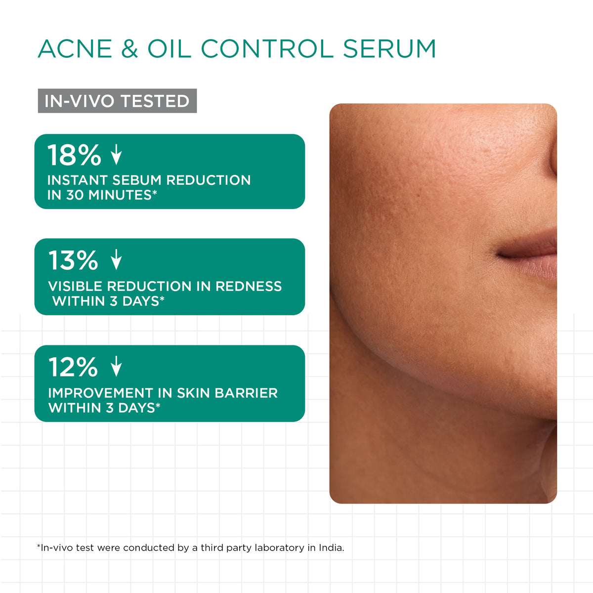 Acne Control Trial Kit