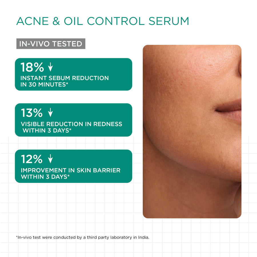 Acne Control Trial Kit