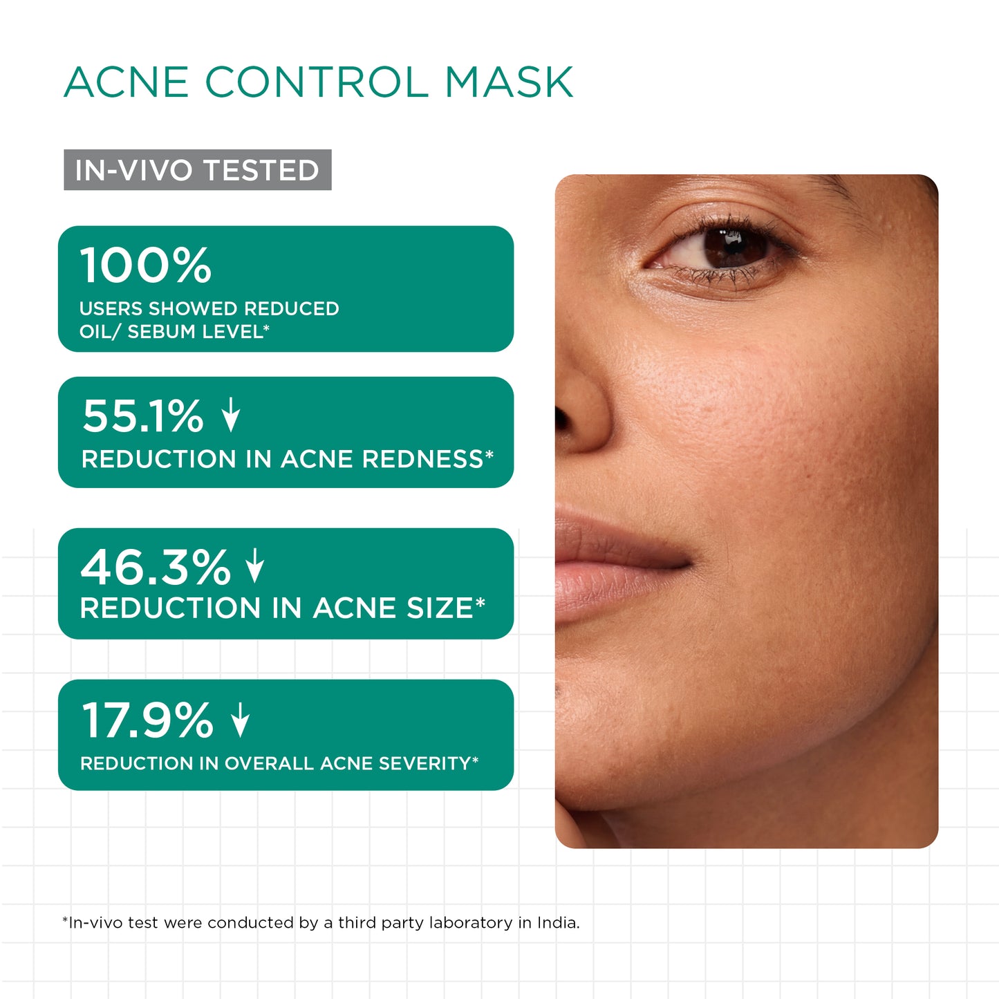 Acne Control & Protect Kit