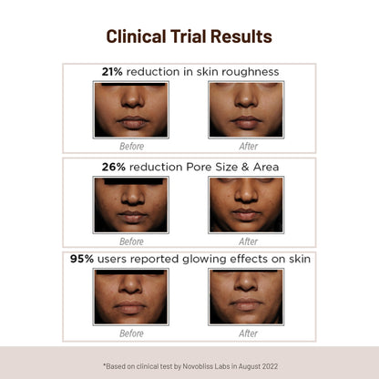 Glow Bright Mask: Instant Skin Brightening Niacinamide Face Mask | Ingredients Glycolic Acid and Niacinamide | DIY Face Mask for Glowing Skin